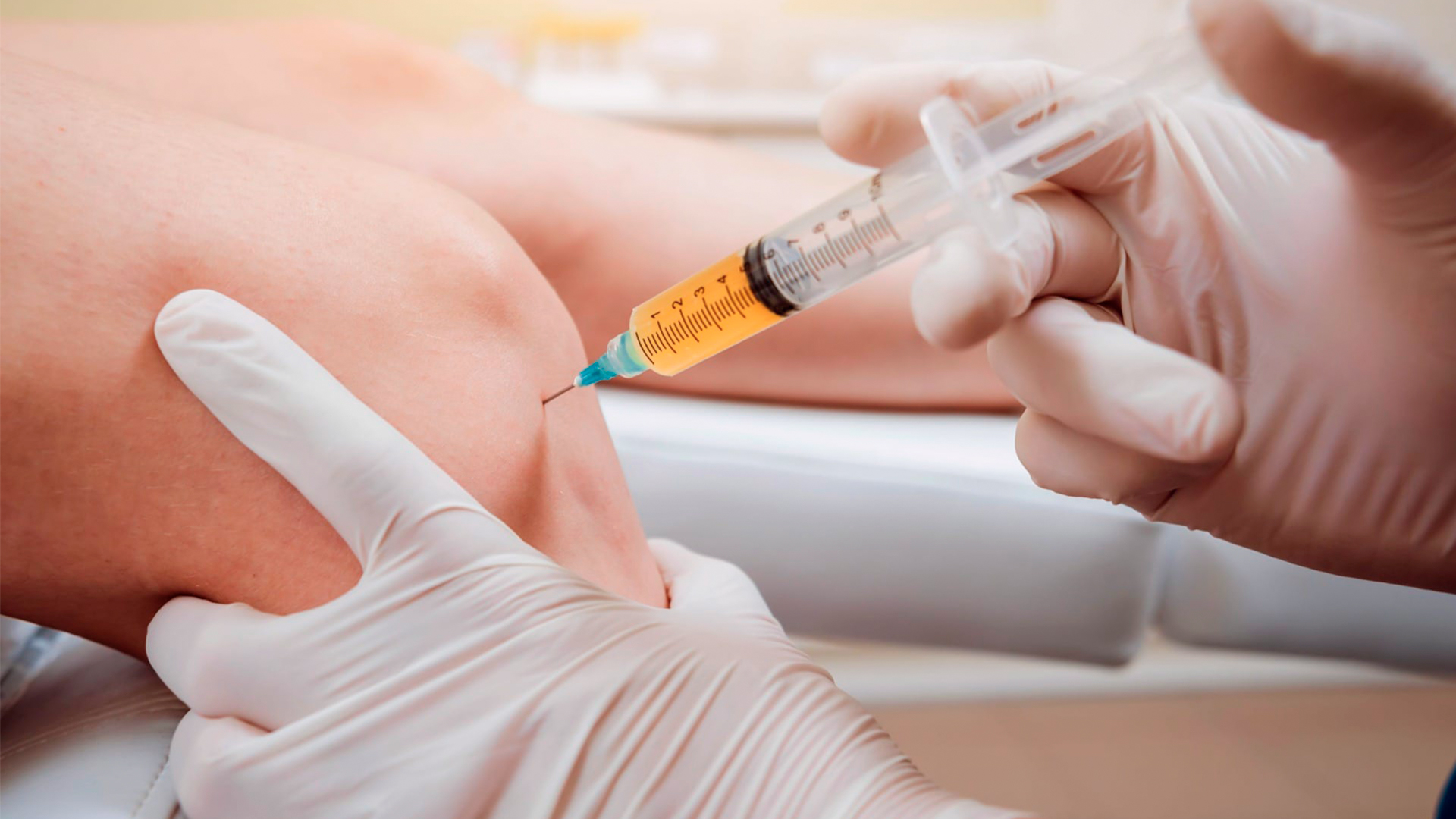 PRP For Pain Therapy